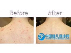 智利ROSAFARM背膜產(chǎn)品 650g罐 綠色膜  背部收細毛孔 改善暗瘡痘印